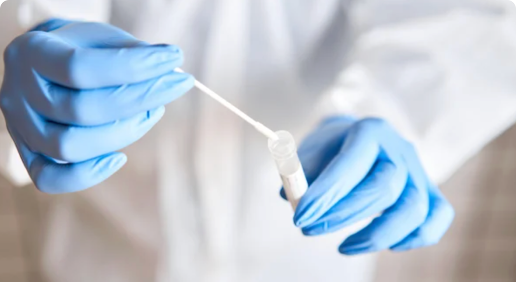 Preanalytical